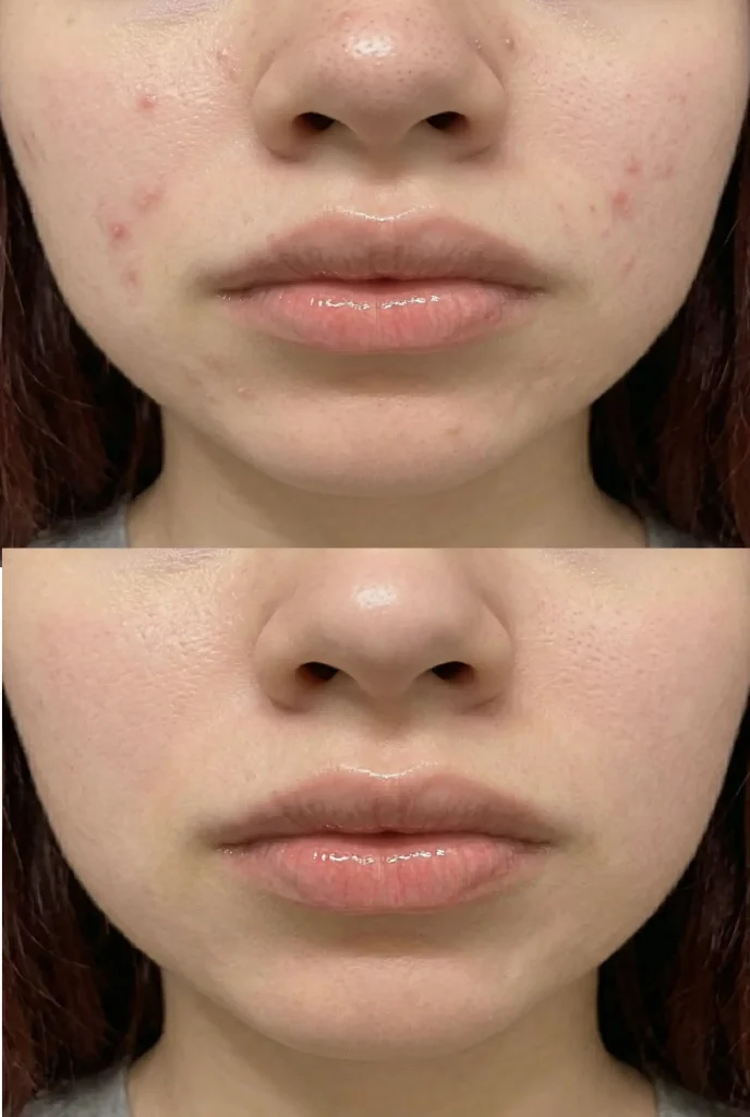 paula's choice 2% bha review